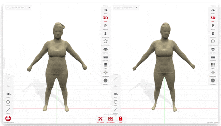 Styku S100, 3D Full Body scanner
